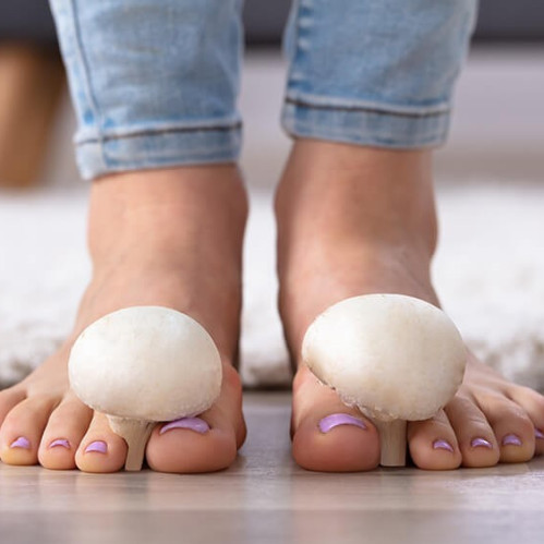 Qo'ziqorin infektsiyasini qanday aniqlash va davolash mumkin.