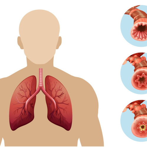Bronxial salomatlik va astma nazorati: nafas olish tizimining ahamiyati