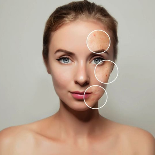 Dermatozlar: qanday aniqlash va samarali davolash