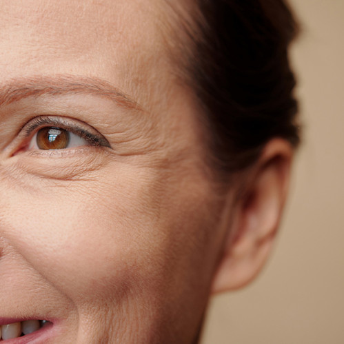 Стоп старение: что помогает избавиться от морщин