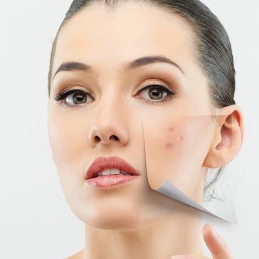 Лосьон для проблемной кожи: как выбрать и применять