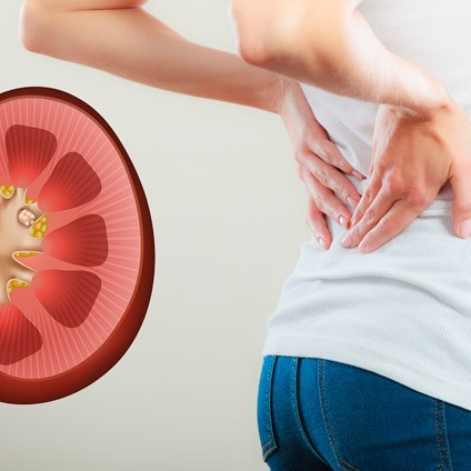 Urolitiaz: buyrak toshlari va ularni yo'q qilishning samarali usullari