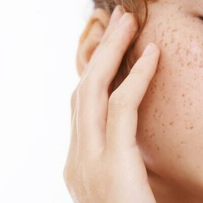 Пигментные пятна: причины появления и эффективные способы устранения