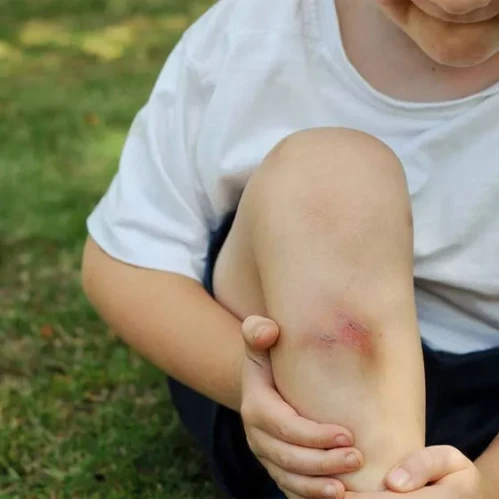 Мази от ушибов. Средства от повреждений мягких тканей. Как правильно выбрать и принимать