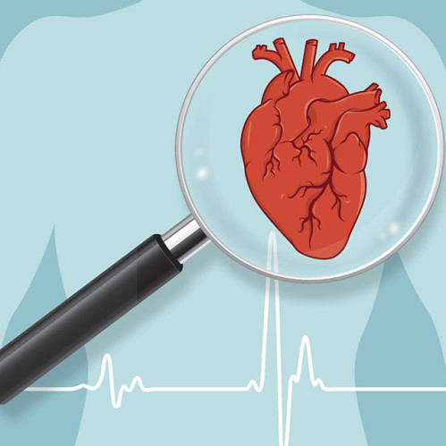 Сердце под защитой: как распознать и предотвратить сердечные болезни