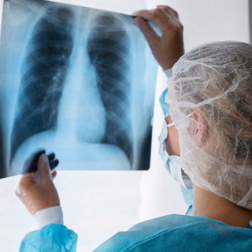 Чем лечить бронхит? Лучшие средства и профилактика острого и хронического бронхита