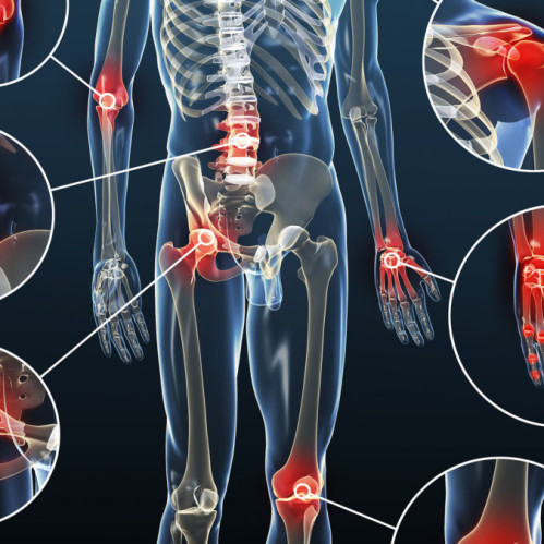 Почему стоит принимать витамины для суставов уже сейчас?
