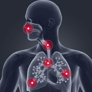Nafas olish yo'llari infektsiyalari: alomatlar, davolash va oldini olish.