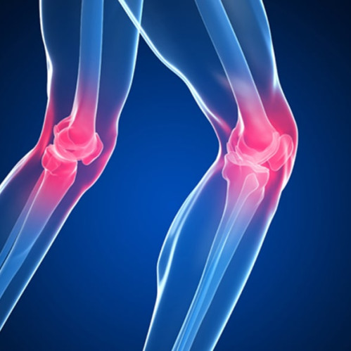 Остеоартроз колена: как распознать, лечить и предотвратить заболевание.