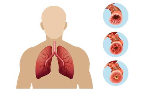 Здоровье бронхов и контроль астмы: важность дыхательной системы