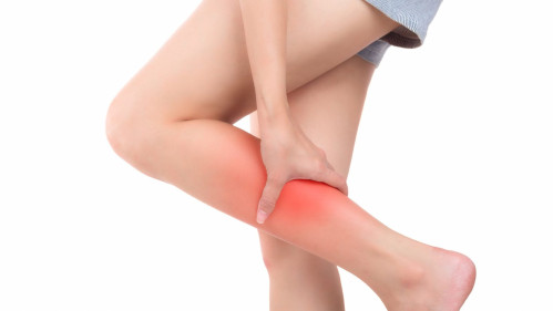 Варикоз: причины, симптомы и эффективные методы лечения