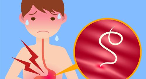 Dushmanglist plyus gelmintozlar uchun: u qanday ishlaydi va nimadan iborat