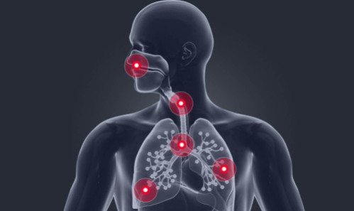 Инфекции дыхательных путей: симптомы, лечение и профилактика.