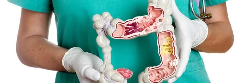 Gemorroy uchun samarali rektal shamlar: ko'rib chiqish va ko'rsatmalar