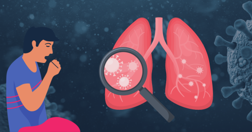 Pnevmoniya va genitoüriner tizim infektsiyalari: qanday tanib olish va kurashish