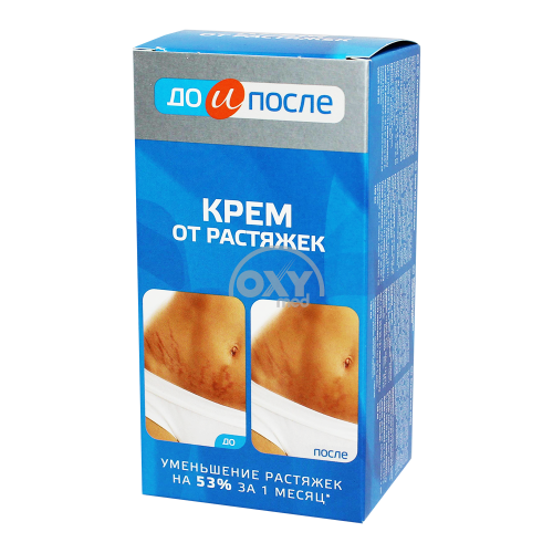product-Крем "До и после" от растяжек 100 мл