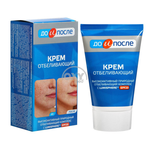 product-Oqartirishdan oldin va keyin krem 100ml