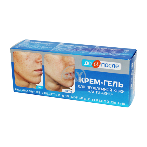 product-078 Крем-гель "ДО И ПОСЛЕ"  д/проб кожи 50мл