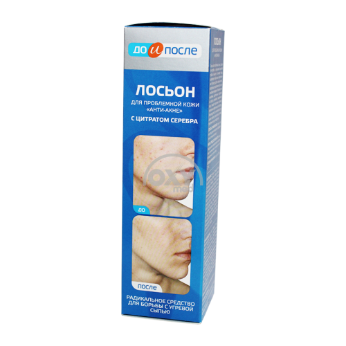 product-Лосьон "ДО И ПОСЛЕ" для проблемной кожи 200 мл