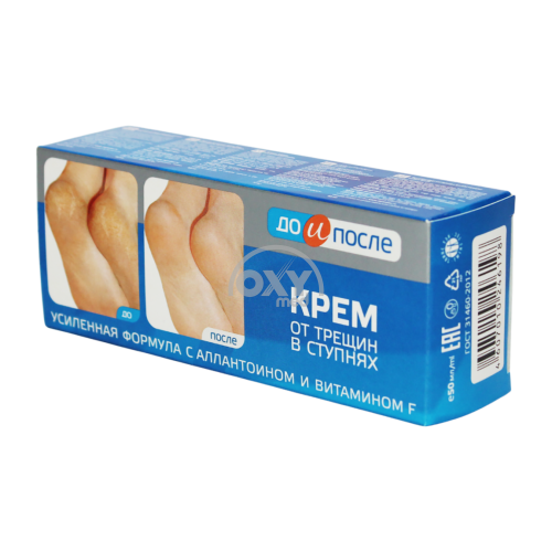 product-Крем для ног "До и после" от трещин 50 мл