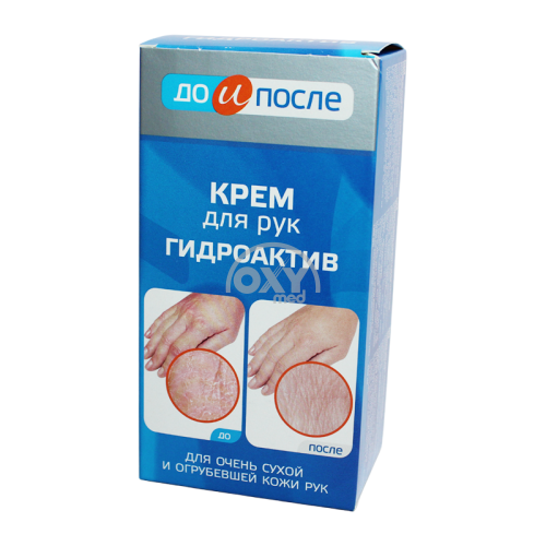 product-Крем для рук "ДО и ПОСЛЕ" Гидроактив 100 мл