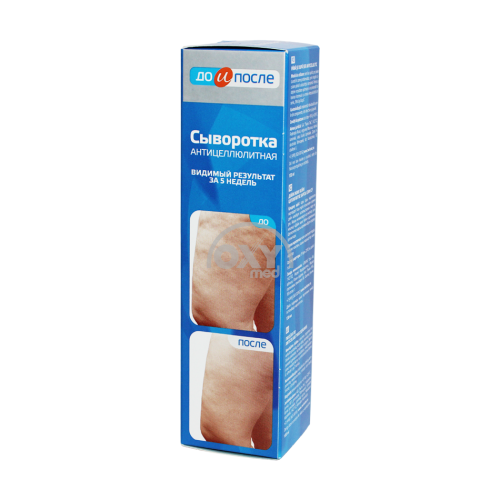 product-Selülitdan oldin va keyin sarum 130ml