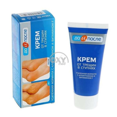product-Крем для ног "До и после" от трещин 50 мл