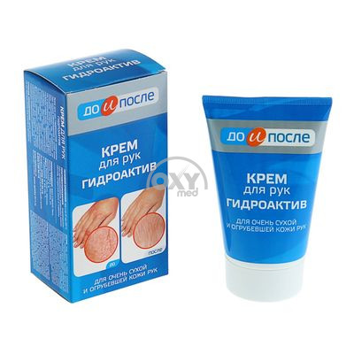 product-Крем для рук "ДО и ПОСЛЕ" Гидроактив 100 мл