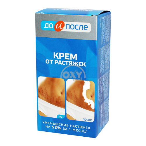 product-Крем "До и после" от растяжек 100 мл