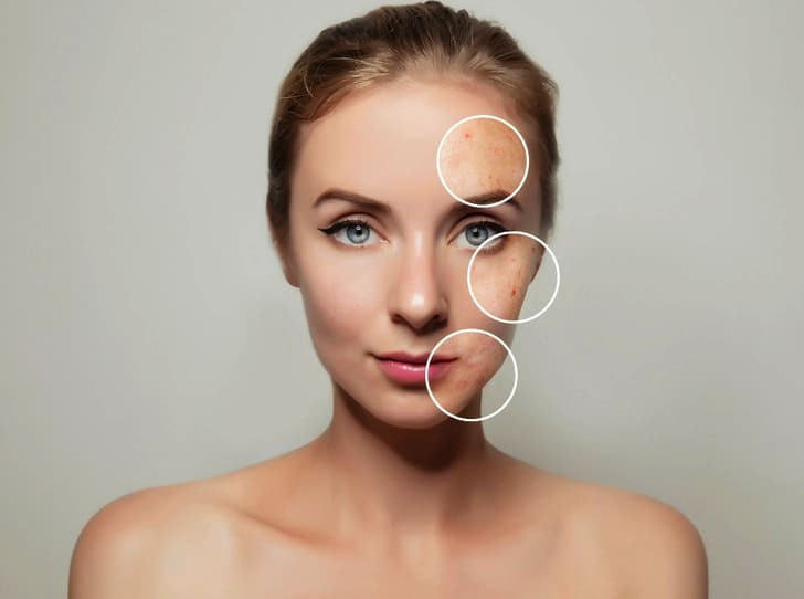 Дерматозы: как распознать и эффективно лечить