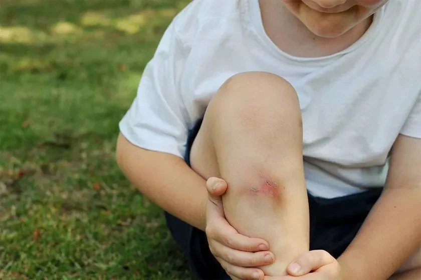 Мази от ушибов. Средства от повреждений мягких тканей. Как правильно выбрать и принимать