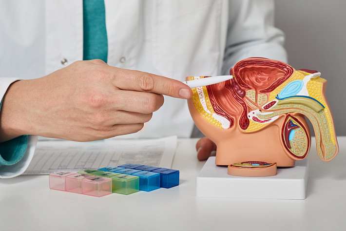 Prostata uchun ovqatlanish: qaysi vitaminlar haqiqatan ham muhimdir
