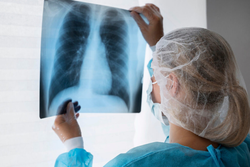 Чем лечить бронхит? Лучшие средства и профилактика острого и хронического бронхита