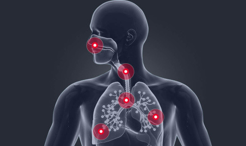 Nafas olish yo'llari infektsiyalari: alomatlar, davolash va oldini olish.