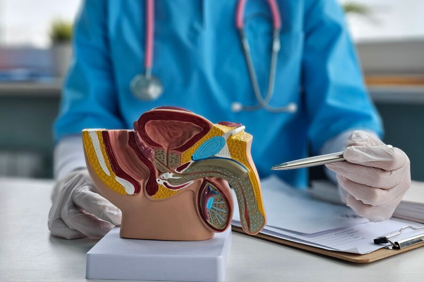 Prostata bezining yaxshi giperplaziyasi bilan qanday kurashish mumkin: erkaklar uchun qo'llanma