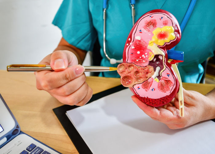 Pielonefritni qanday engish mumkin: dorilar, maslahatlar, oldini olish